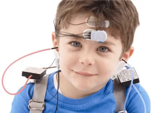 audiomax-potenciales-evocados-integrity-v500-vivosonic