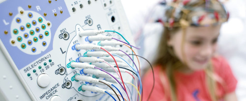 electroencefalograma-tipos-500